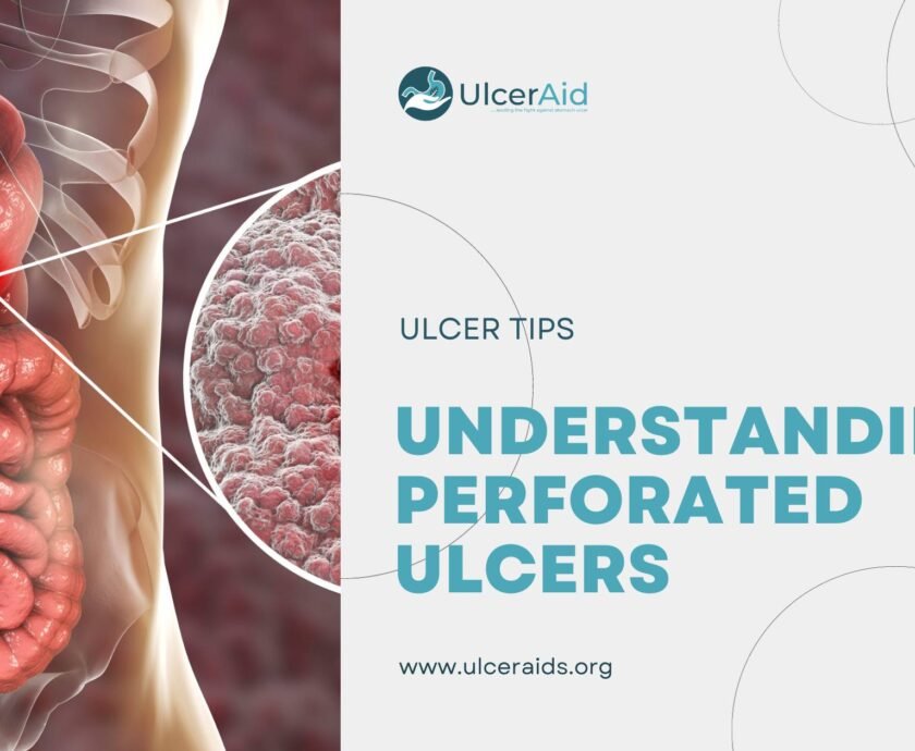 understanding perforated ulcers